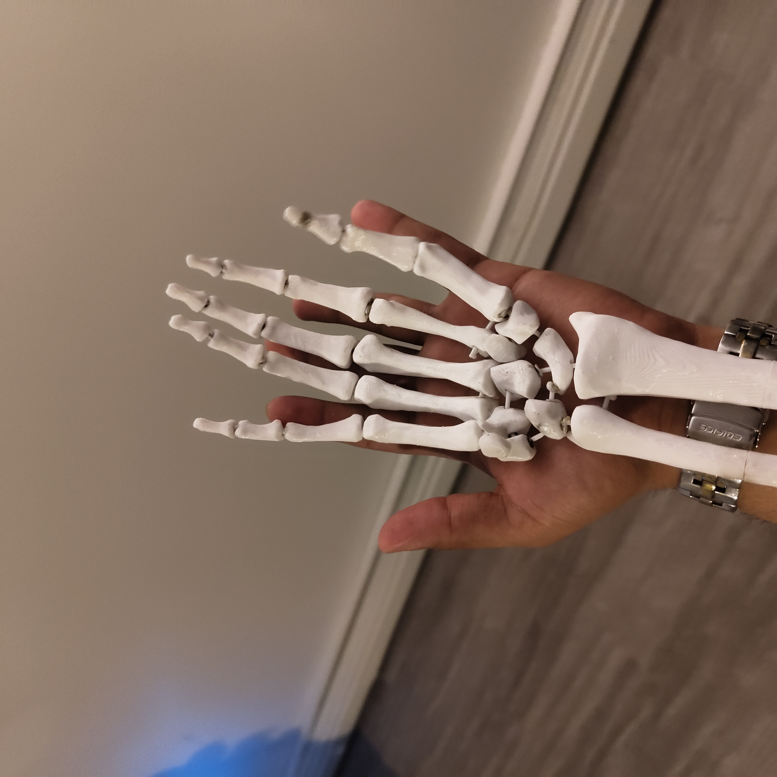 Prosthetic Hand Build Log